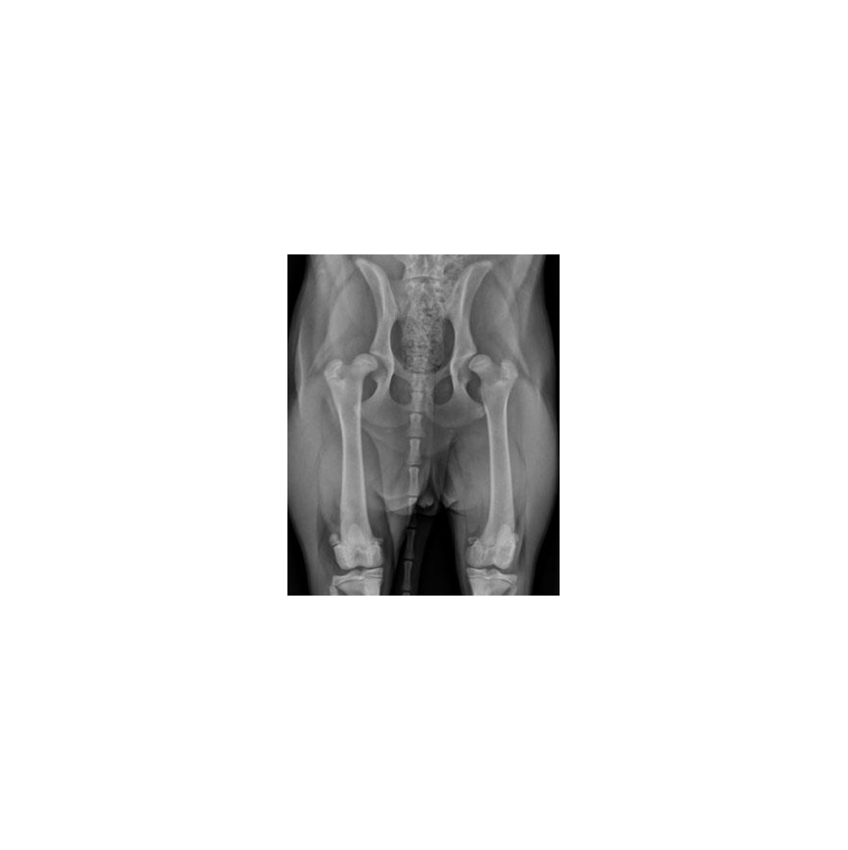 X-Ray of patient before TPO surgery