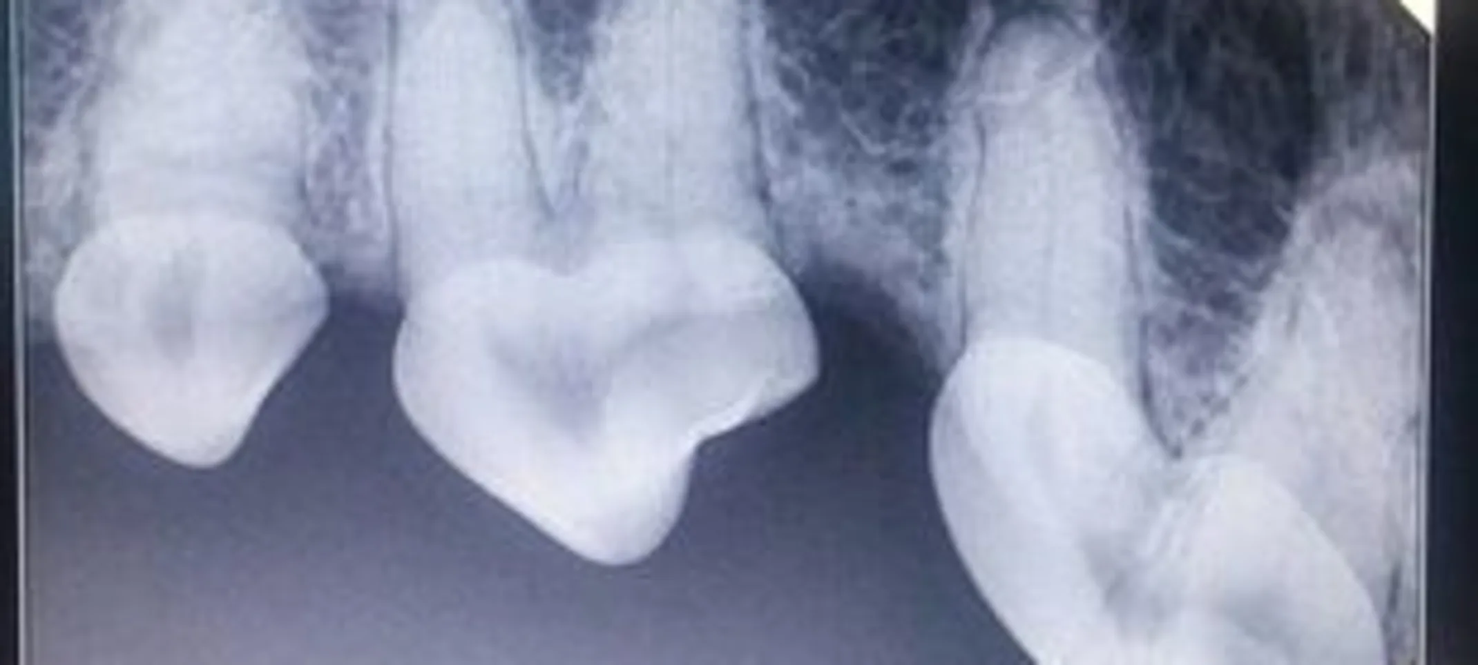 Dental X-ray of dogs mouth Dental X-ray of dogs mouth