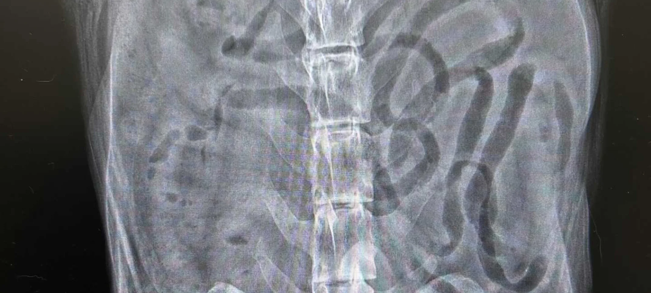 Xray Xray