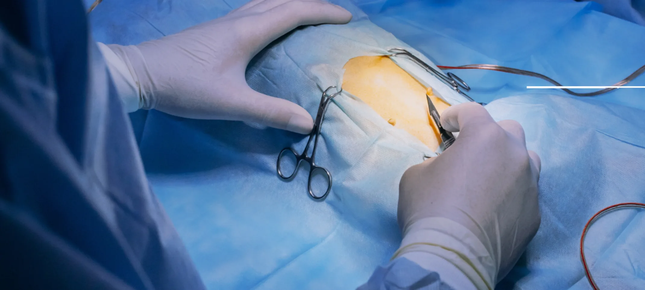 Two Staff About to Start Surgery on Dog Two Staff About to Start Surgery on Dog