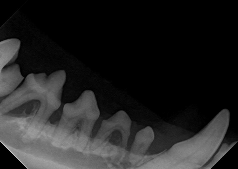 The roots are barely covered by bone. The bone should cover 100% of the root and in this case it ranges from 50% down less than 10%. Anything below 50% and typically the tooth should be removed or have a root canal. This mouth looked NORMAL ON EXAM