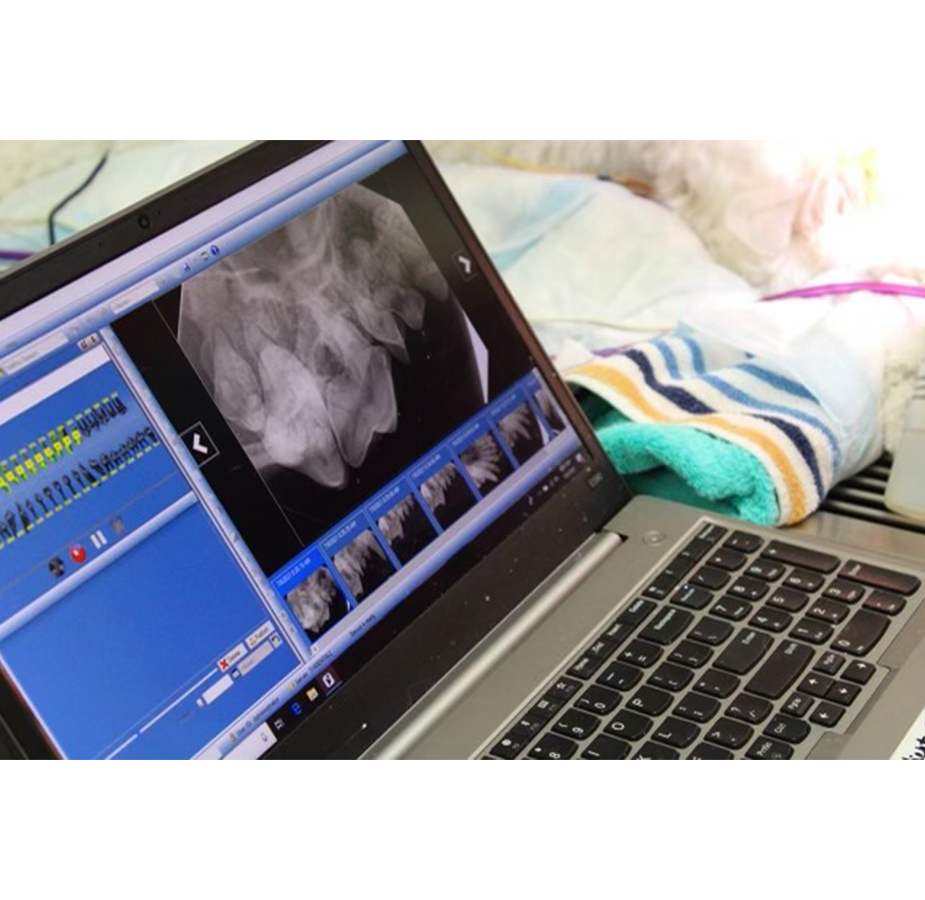 CLOSE UP OF COMPUTER DURING SURGERY