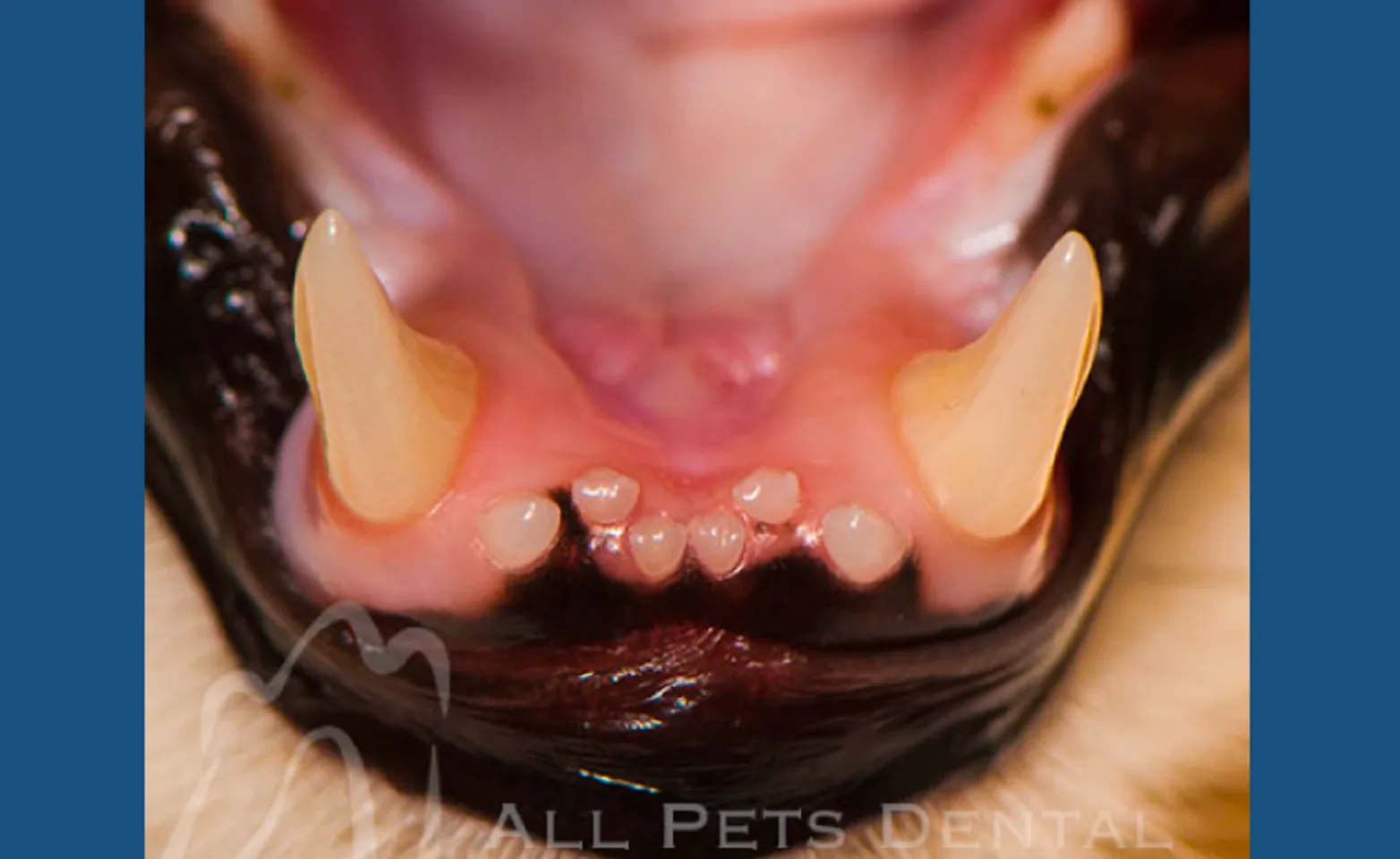 Crowded Teeth Crowded Teeth