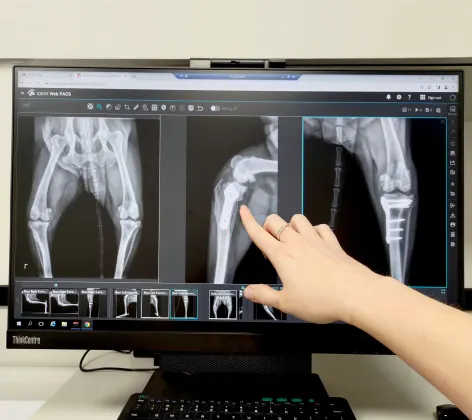 Hand Pointing to X-Ray Scans