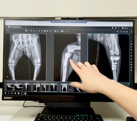 Hand Pointing to X-Ray Scans