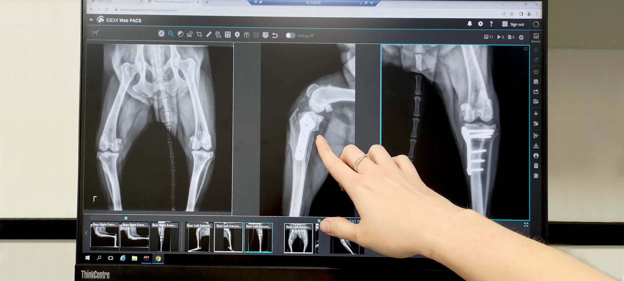 Hand Pointing to X-Ray Scans Hand Pointing to X-Ray Scans