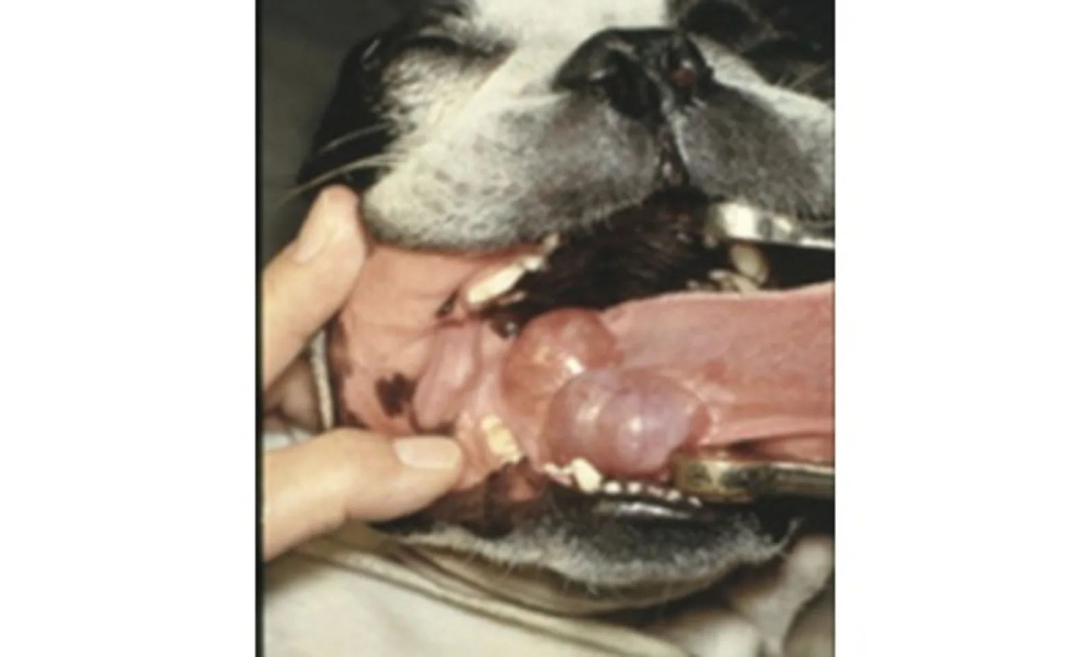 Sublingual Sialocele Sublingual Sialocele