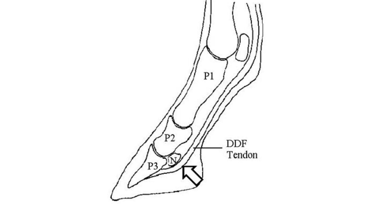 Navicular Inflammation Illustration