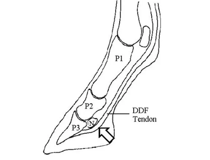 Navicular Inflammation Illustration Navicular Inflammation Illustration