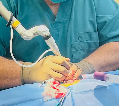 Surgical laser at Southside Animal Hospital Surgical laser at Southside Animal Hospital