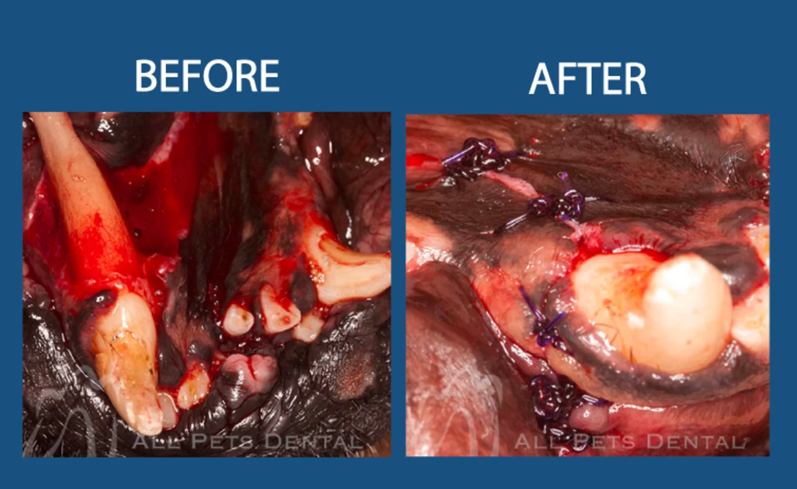 Avulsed tooth prior to procedure: Before & After Surgery