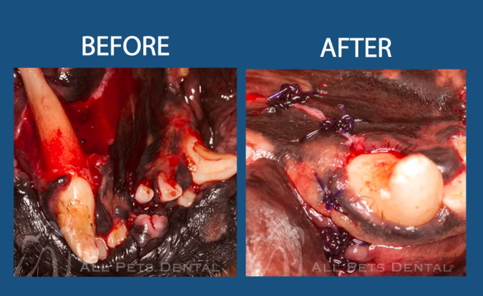 Avulsed tooth prior to procedure: Before & After Surgery Avulsed tooth prior to procedure: Before & After Surgery