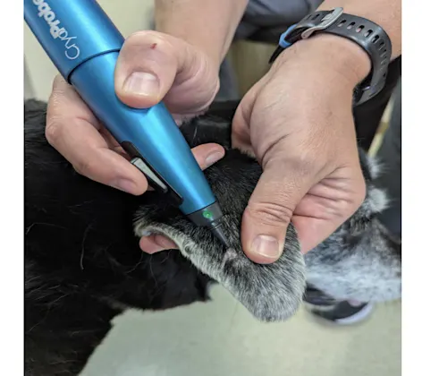 Cryotherapy pen being used on patient Cryotherapy pen being used on patient