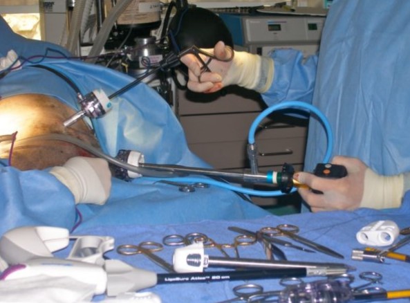 Veterinarians performing a Laparoscopic Ovariectomy surgery