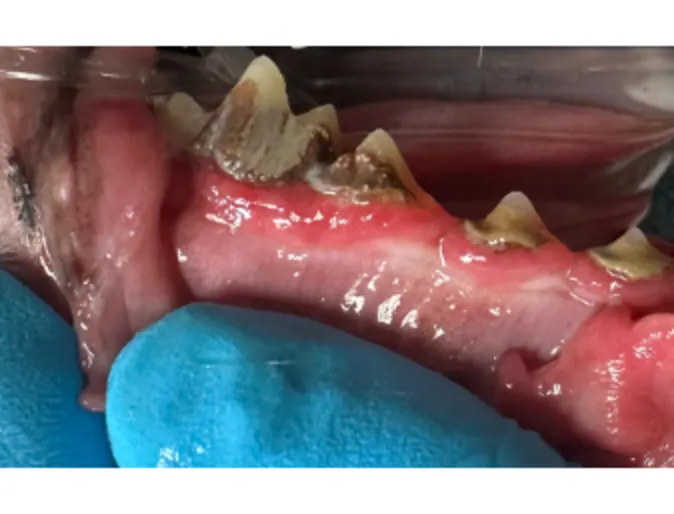 Grade 3 tooth root abscess Grade 3 tooth root abscess