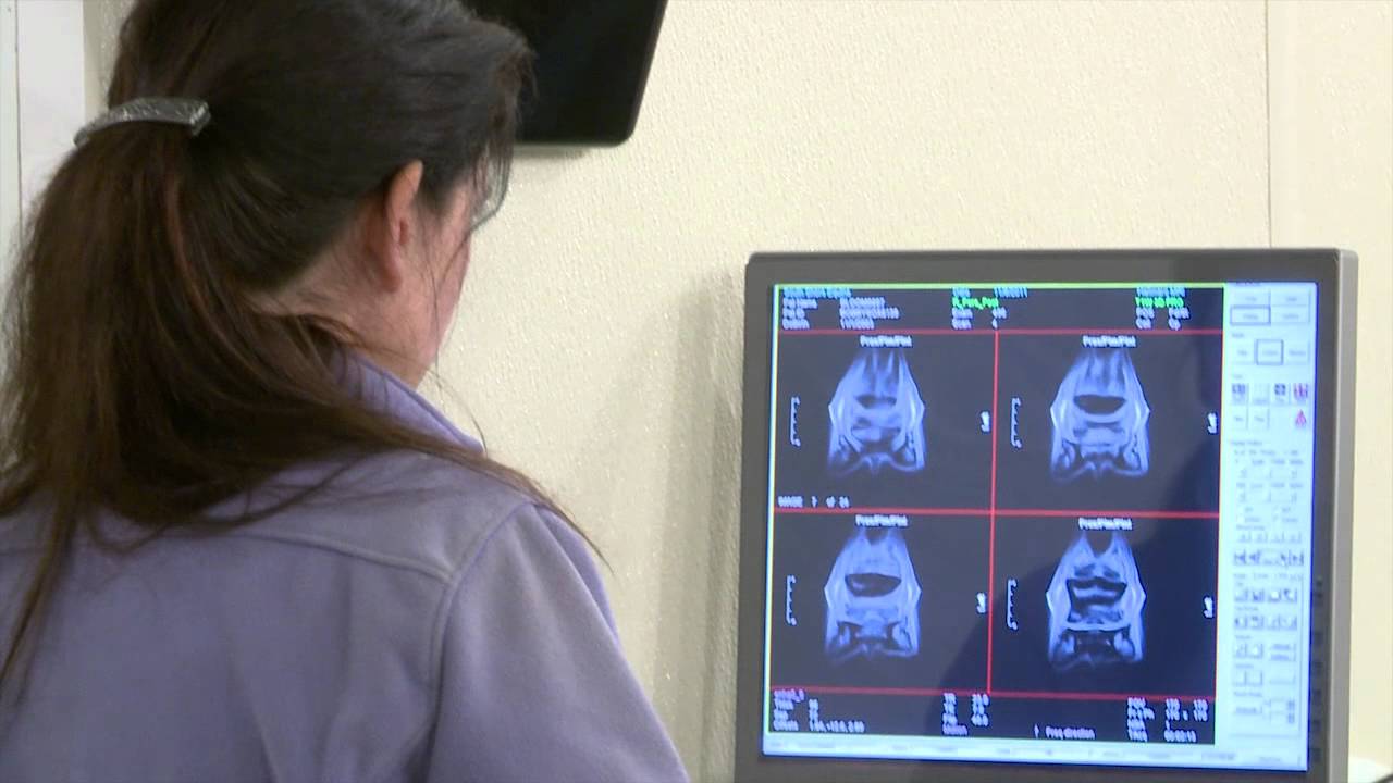 Benefits of MRI Video