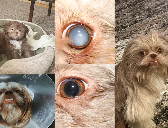 cataracts case study photo - charlie cataracts case study photo - charlie