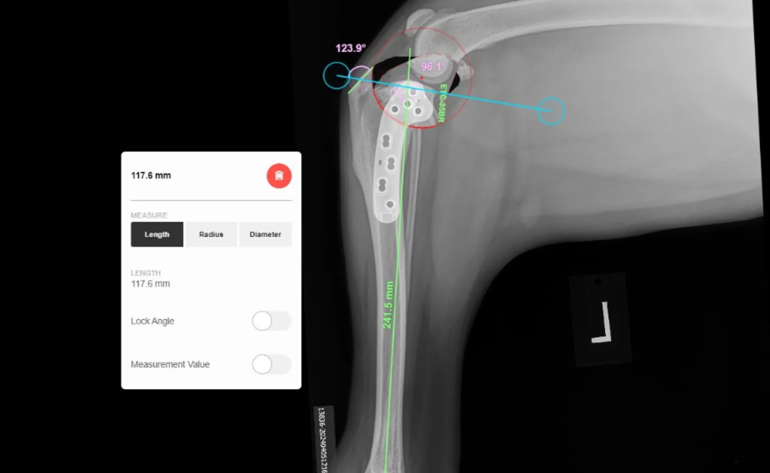 TPLO Surgery TPLO Surgery