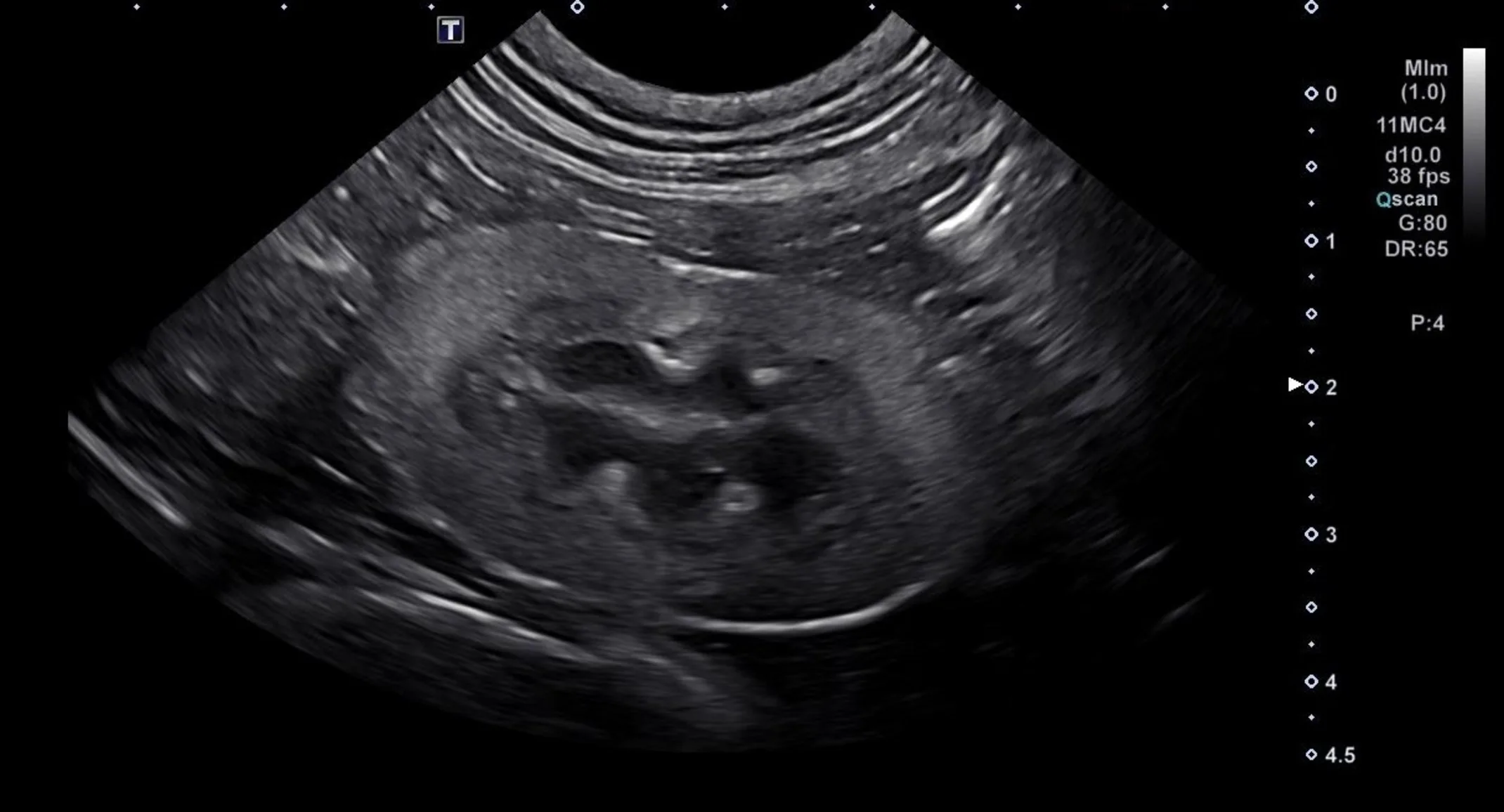 Kidney Pumpkin Kidney Pumpkin