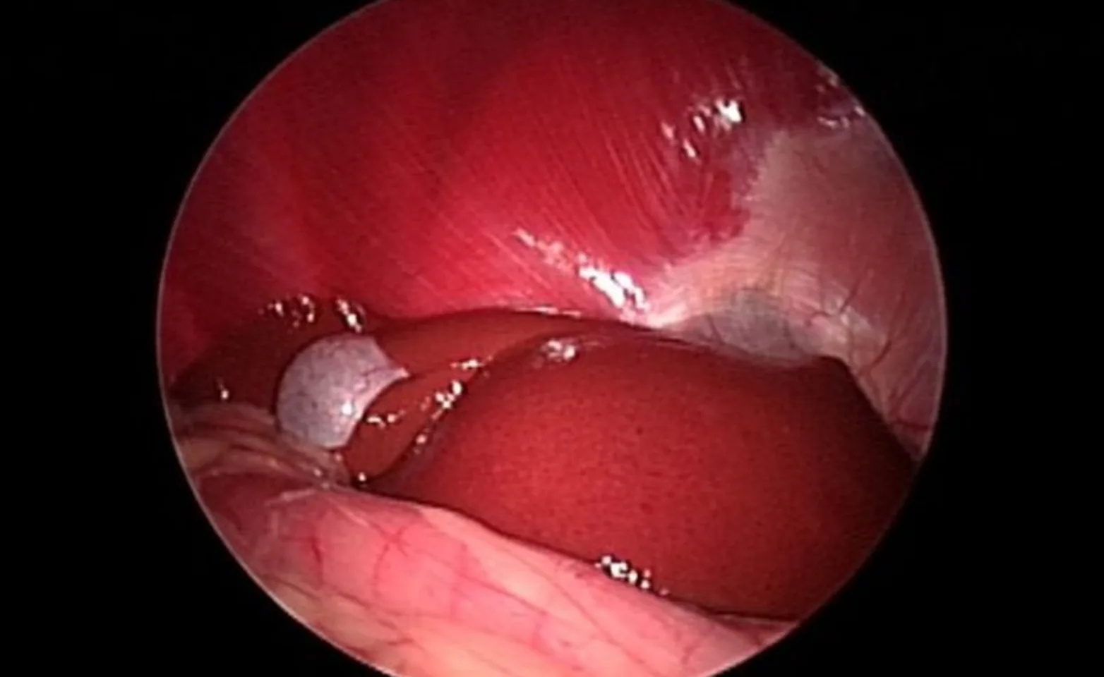 Healthy liver Healthy liver