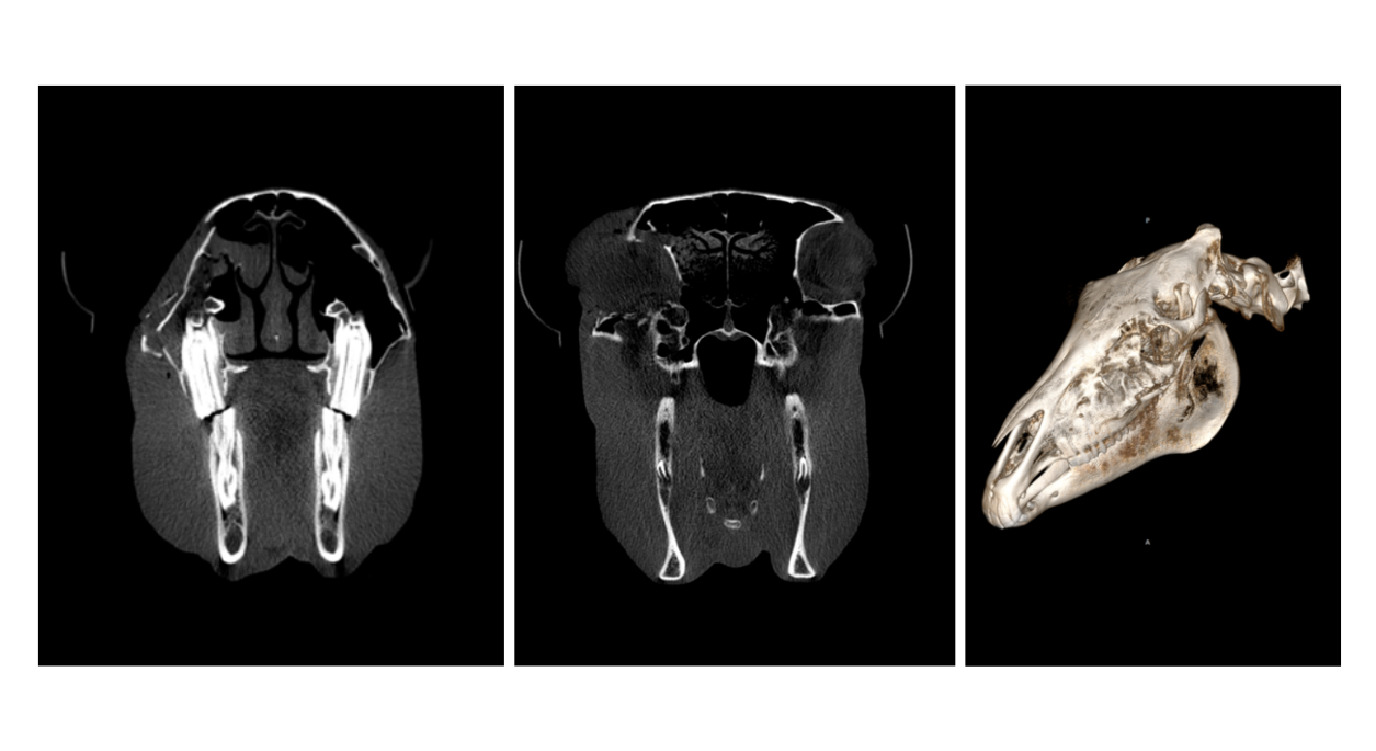 Head CT Case Study