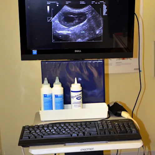 Ultrasound Ultrasound