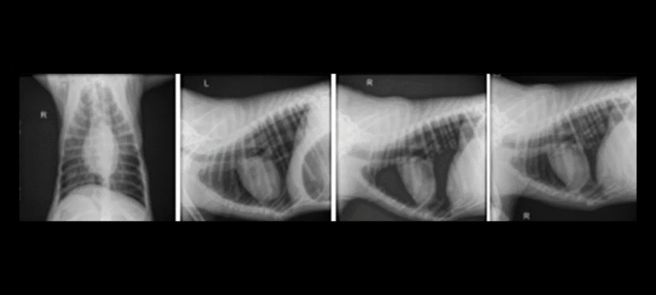 Riggins' XRay Charts Riggins' XRay Charts