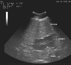 Horse Digital Ultrasound