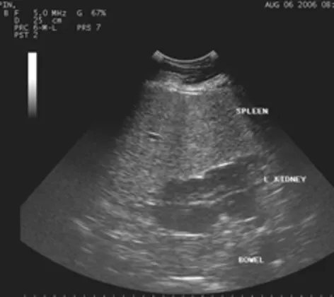 Horse Digital Ultrasound Horse Digital Ultrasound