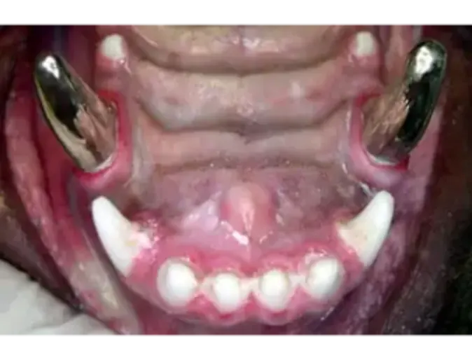 Pet's teeth with metal crowns Pet's teeth with metal crowns