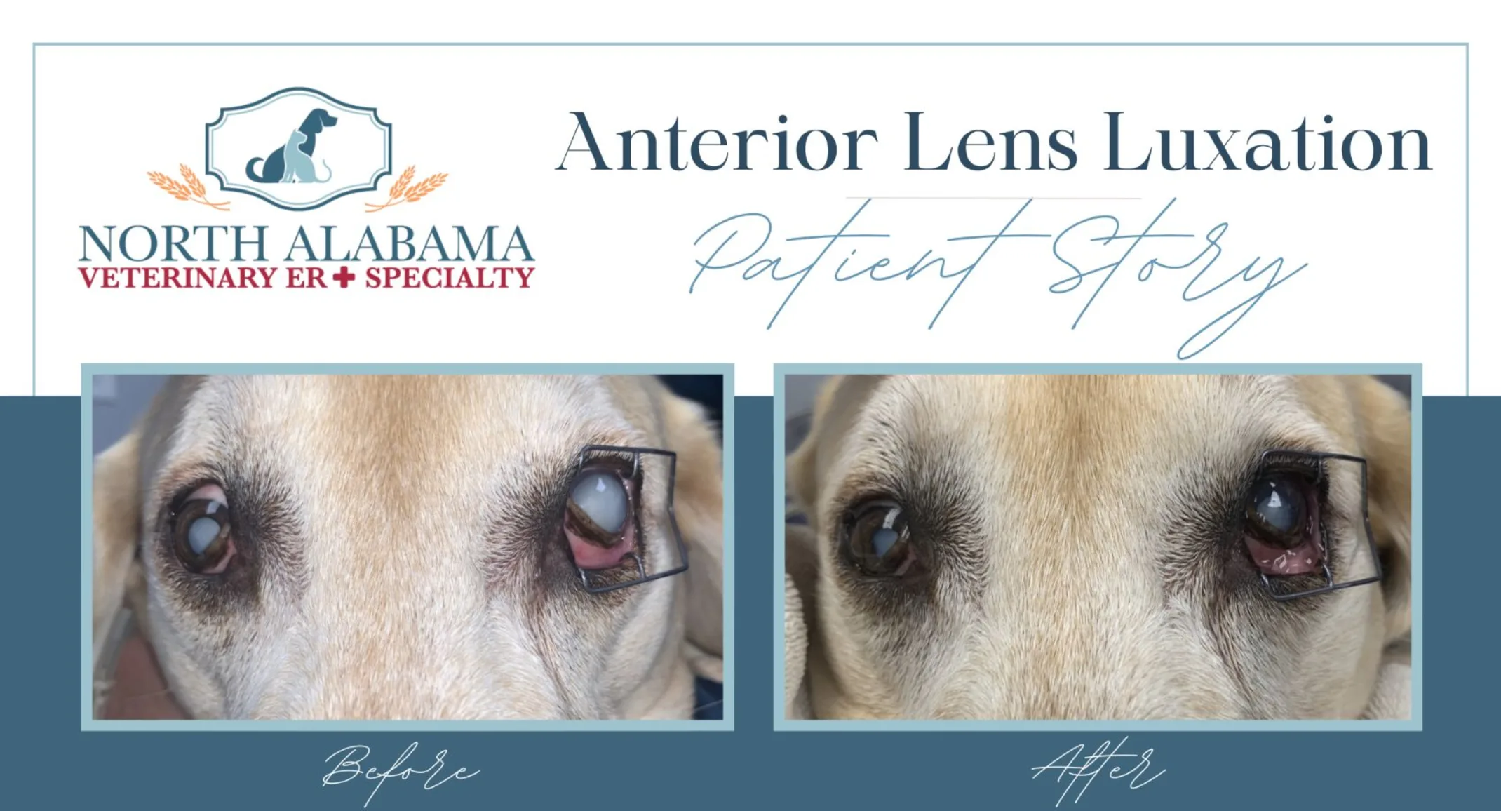 Anterior Lens Luxation on dog Anterior Lens Luxation on dog