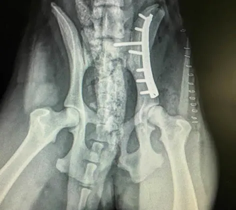 Image of hip surgery Image of hip surgery