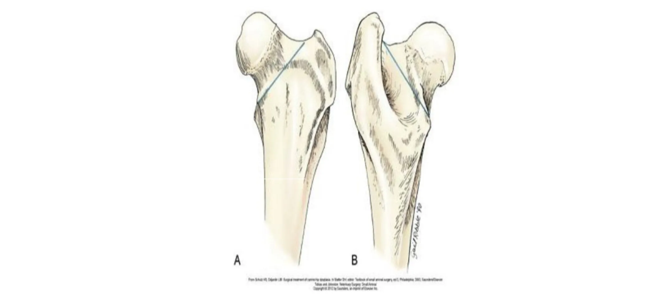 The recommended line of transection on the hip bones The recommended line of transection on the hip bones