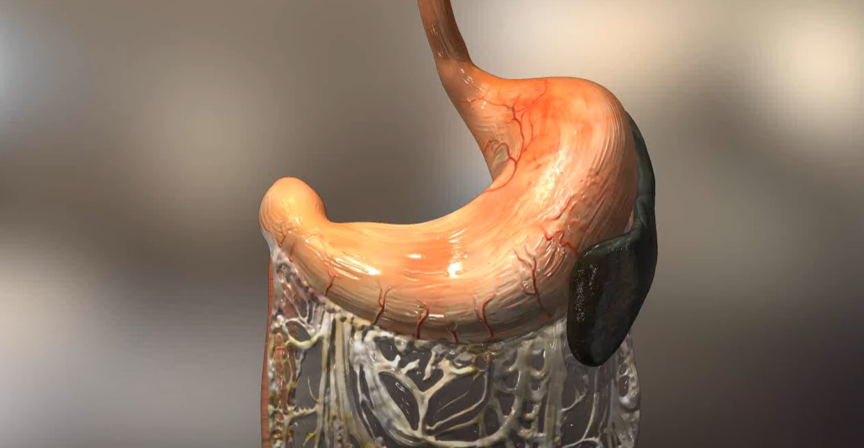 Patterson Veterinary DIA Client Education Video - Gastric Dilatation-Volvulus (GDV)- Bloat