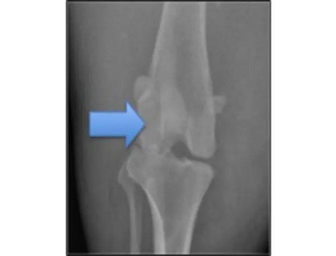Radiograph of normal canine stifle Radiograph of normal canine stifle