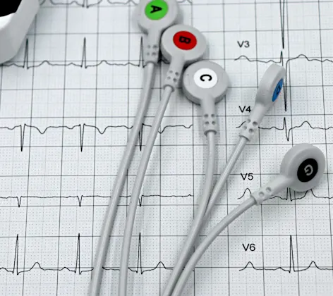EKG deviceand chart EKG deviceand chart