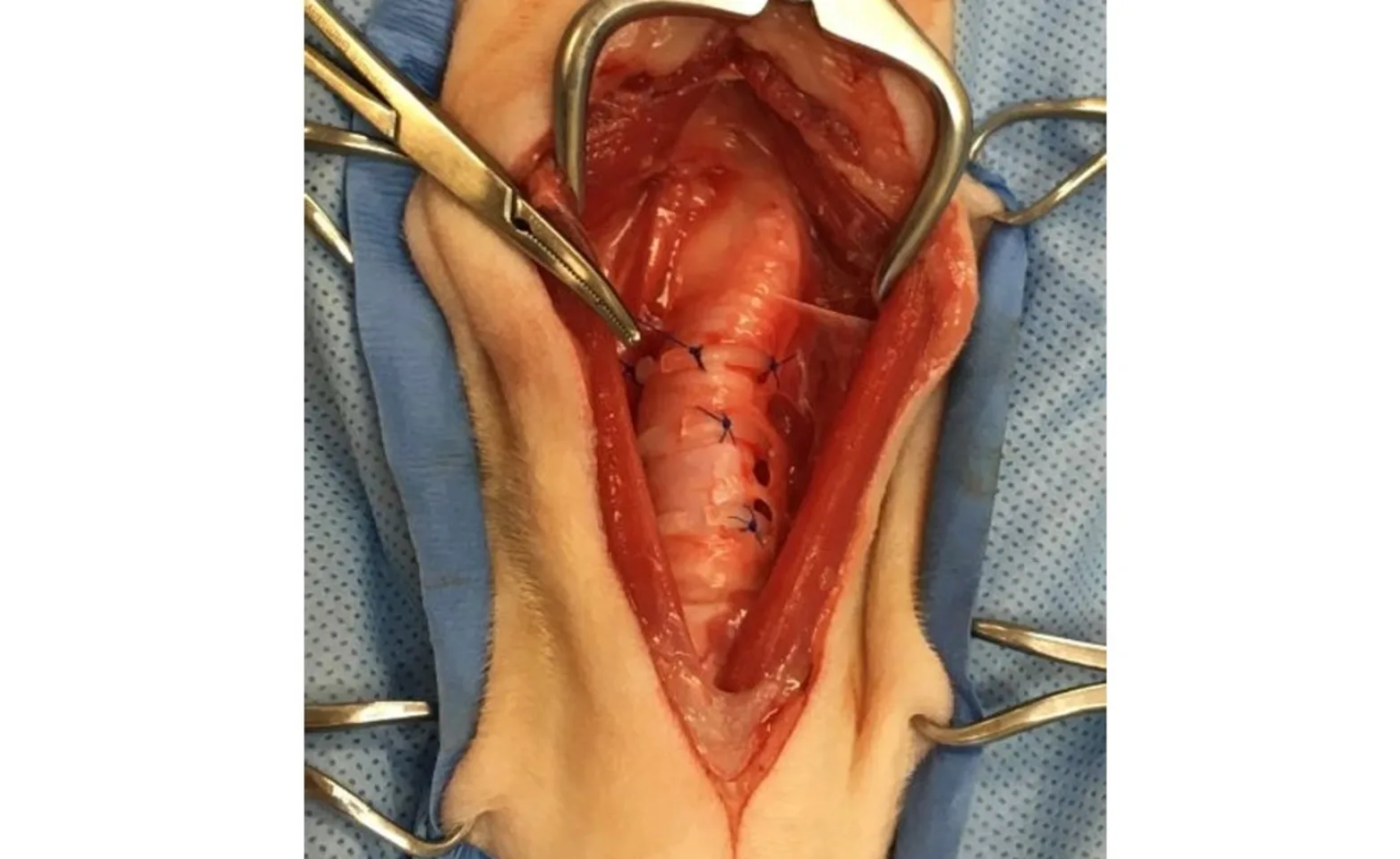 Trachea with extraluminal tracheal rings in place. Trachea with extraluminal tracheal rings in place.