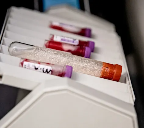 Test tubes Test tubes