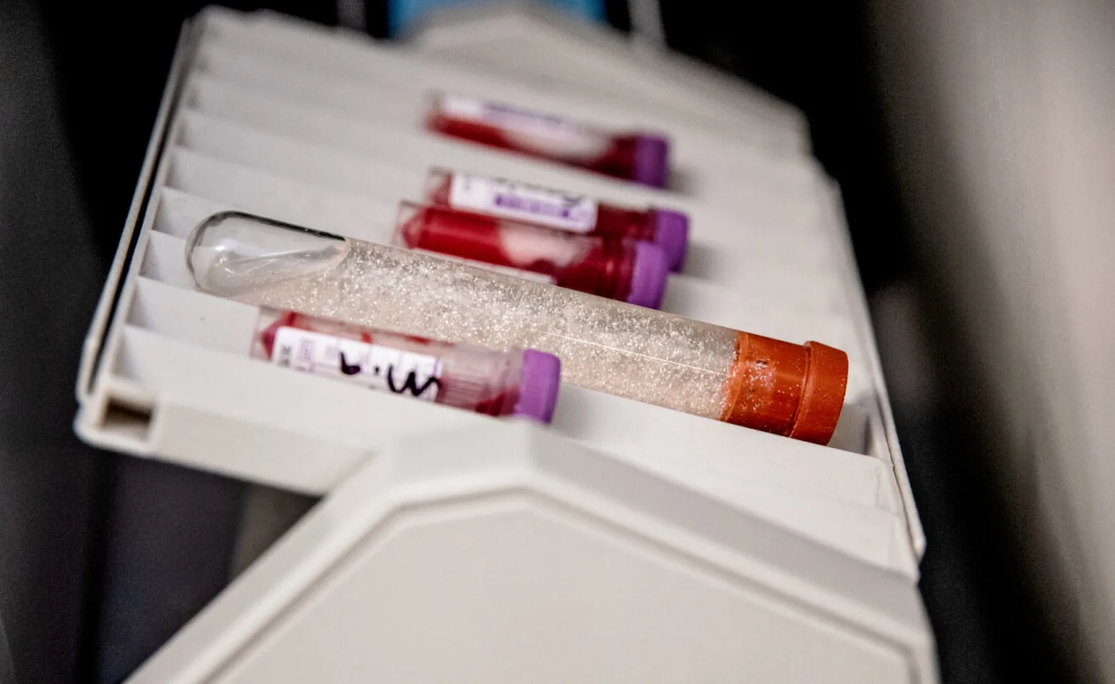 Test tubes Test tubes