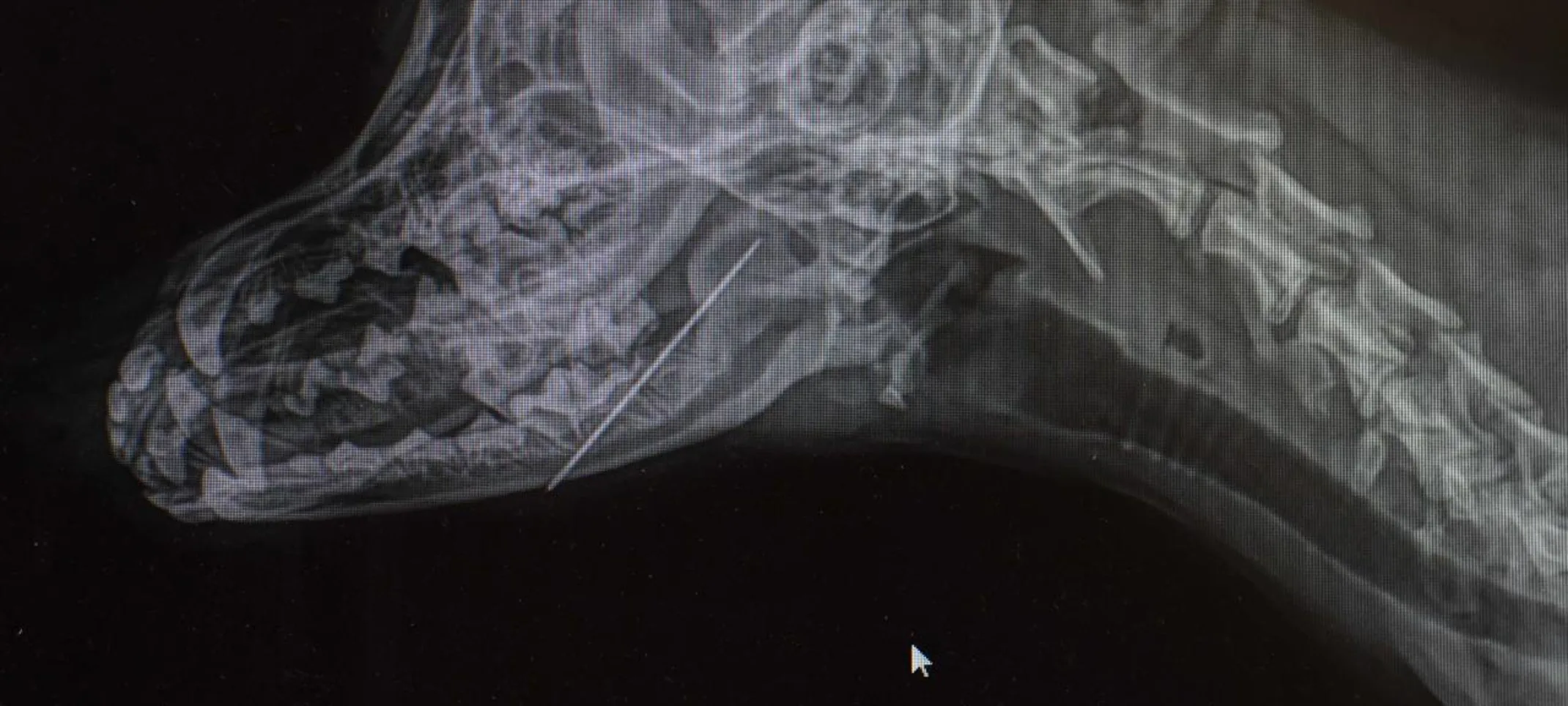 Radiography at Animal Medical Center of Hattiesburg. Radiography at Animal Medical Center of Hattiesburg.