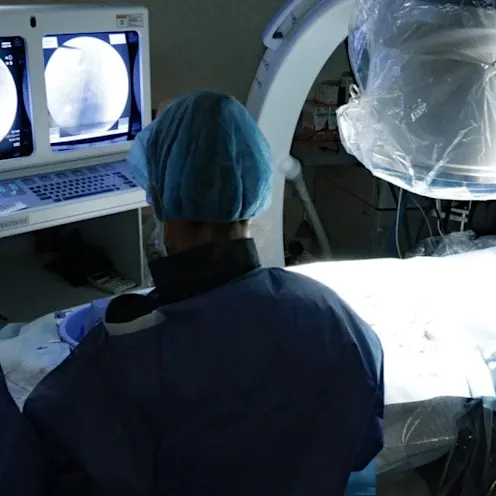 Chemoembolization Chemoembolization