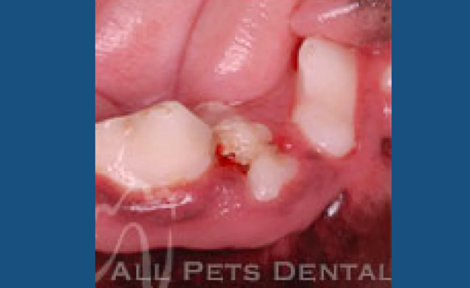 Rotated Teeth Rotated Teeth