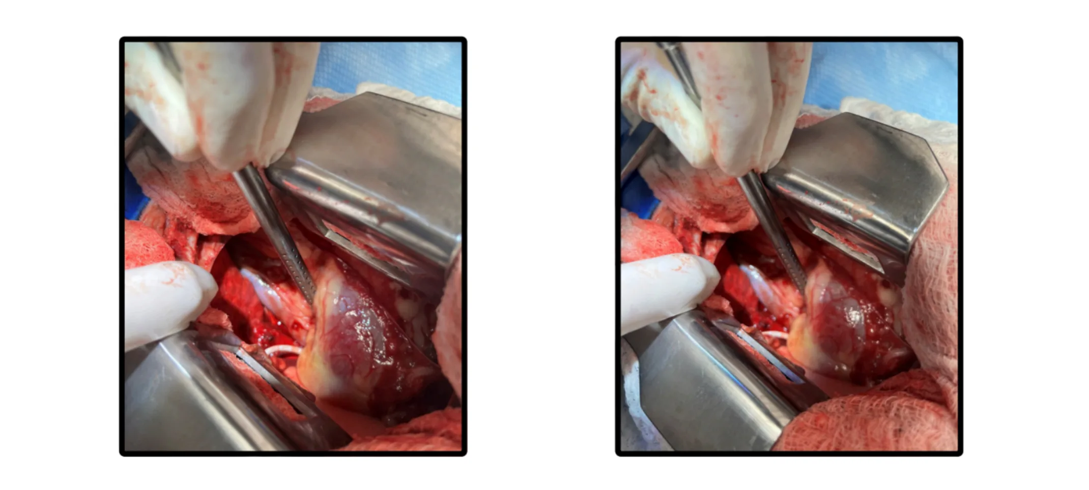 Surgical Intervention Surgical Intervention