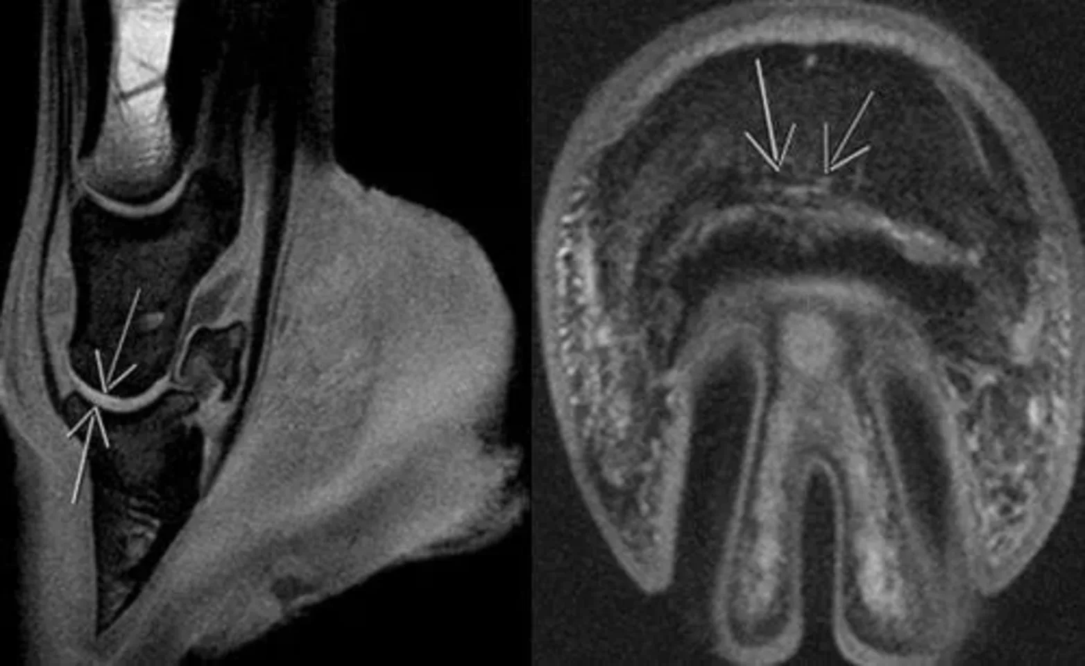 MRI Machine MRI Machine