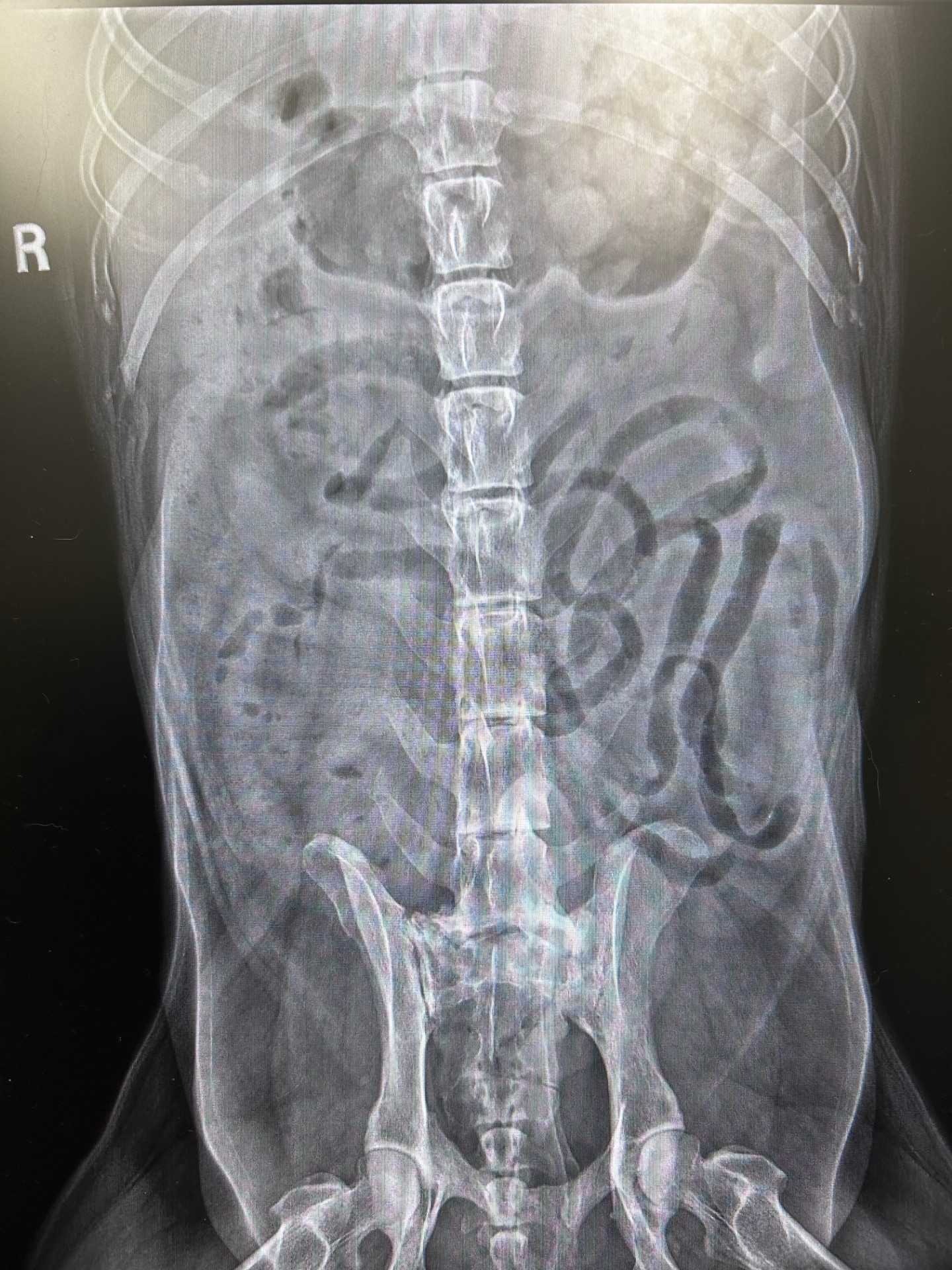 LVCC West x-ray
