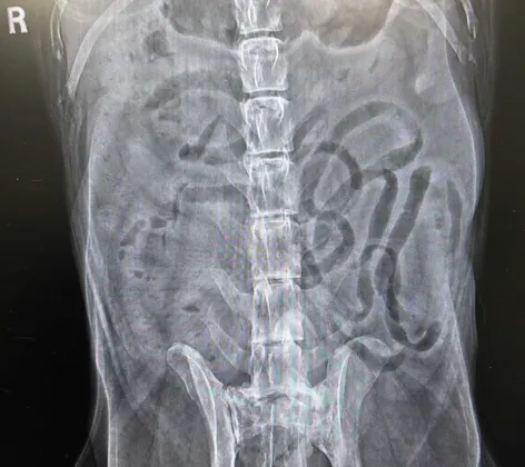 LVCC West x-ray LVCC West x-ray