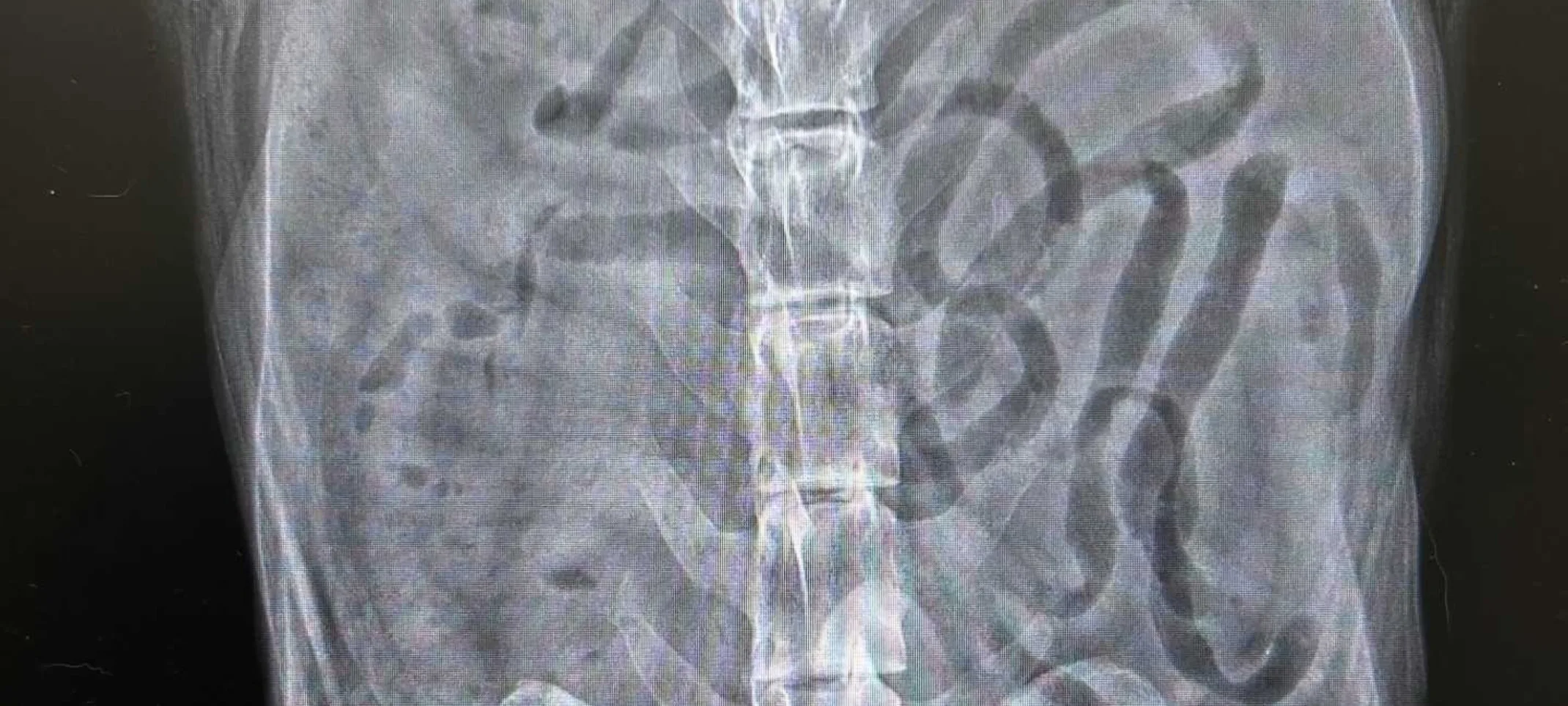 LVCC West x-ray LVCC West x-ray