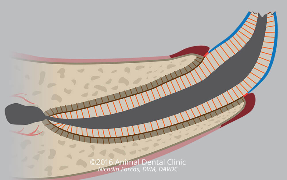Diagram of a fractured tooth