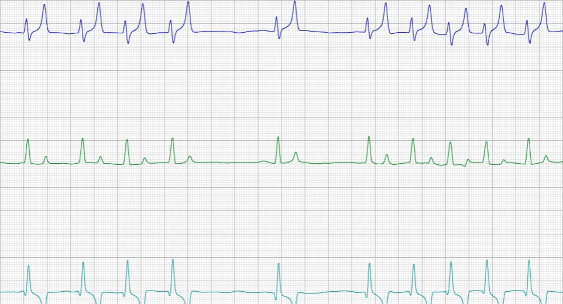Echocardiogram Echocardiogram