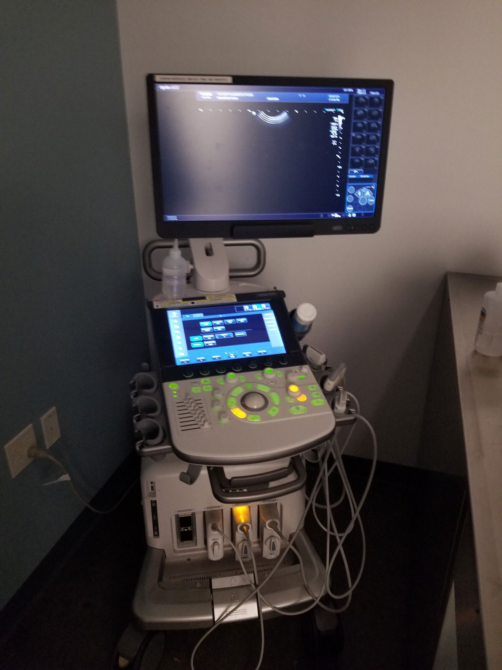 Ultrasound Machine Screen